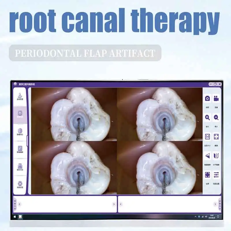 T9 New Dental Intra Oral Camera Wifi Screen Visual Root Canal Removal/mouth Mirror/Endo Motor Treatment High Allocation 3