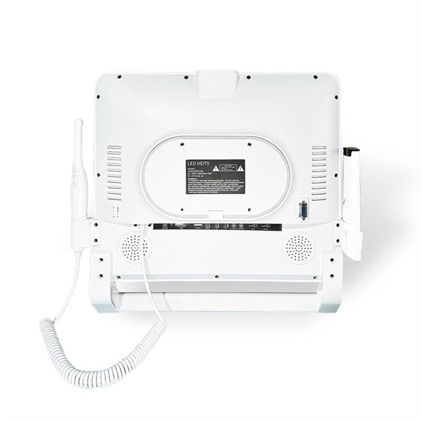 The Benefits of Camera Intraoral WIFI