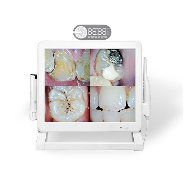 How Teeth Cameras are Revolutionizing Dental Care