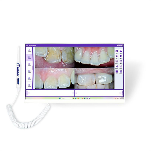 Visualize Your Way to Better Dental Health with a Teeth Camera