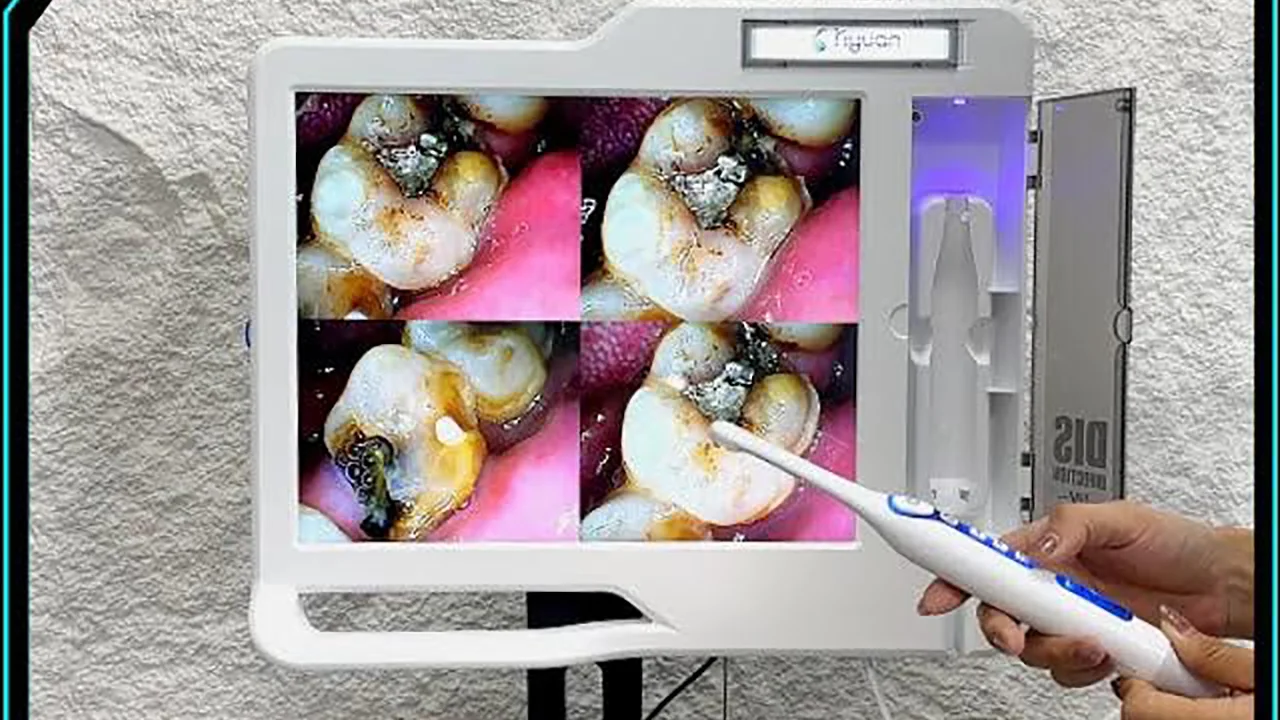 High-quality dental intraoral camera HD LED screen with built-in UV dust bin design