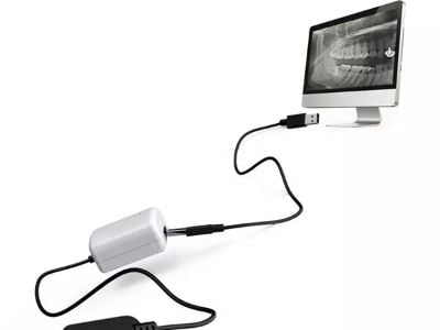 The Benefits of Digital RVG Sensors in Dental Radiography