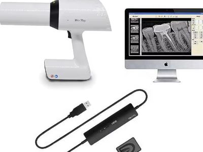 The Future of Intraoral Cameras in Digital Dentistry